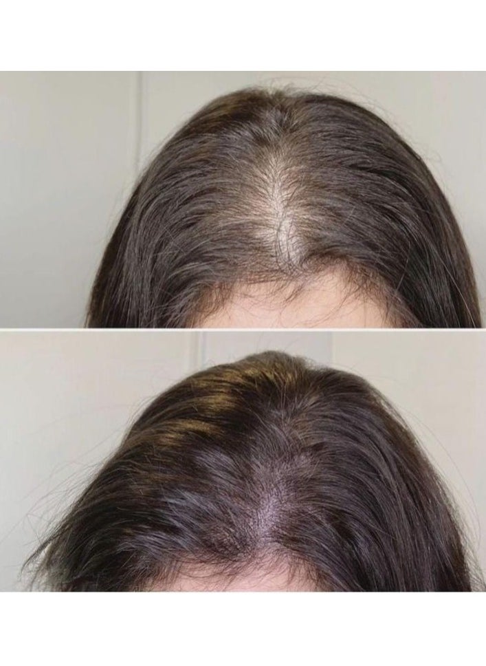 Faster - Faster Strong Black Garlic Oilex Oil Hair Growth -100 Ml - Image 1