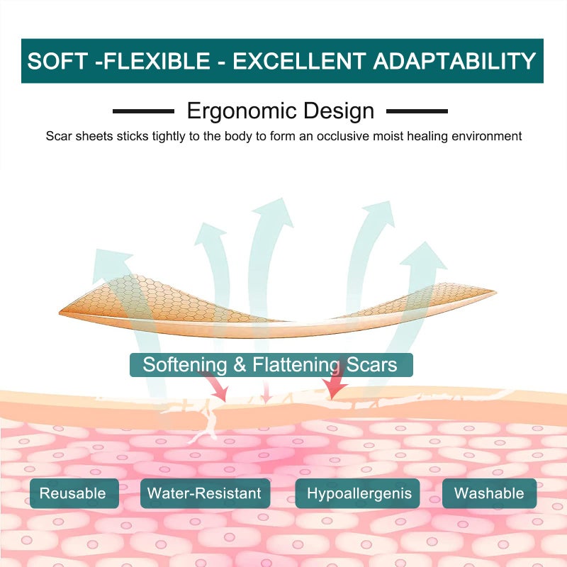ZODENIS شرائح سيليكون لعلاج الندبات (1.6 بوصة × 120 بوصة - لفة 3M)، لفة شريط سيليكون للندبات، شرائح سيليكون للندبات، قابلة لإعادة الاستخدام، شرائح احترافية لإزالة الندبات للولادة القيصرية، الجراحة، الحروق، الكيلويد، حب الشباب وما إلى ذلك. - Image 4