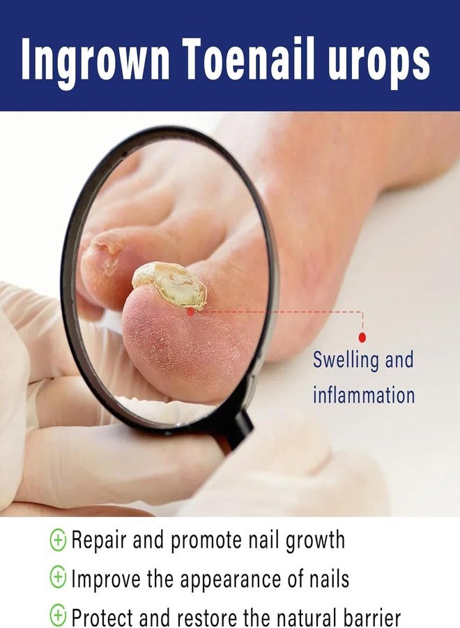 SYLVERA Nail Softener & Ingrown Toenail Relief Drops | Helps Ease Pain, Swelling & Discomfort | Daily Nail Care Solution 30ml (Pack Of_1) - Image 2