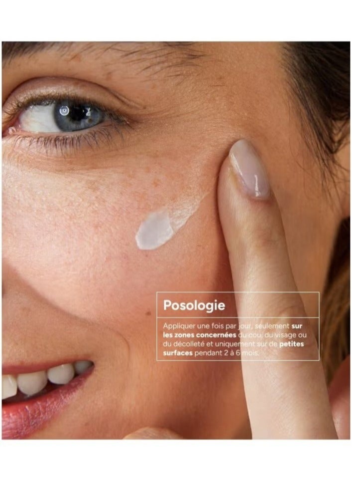 اكم لابرتوري ديرماتولوجيك قناع Dépiwhite لتفتيح البشرة - 40 مل، قناع لتقشير البشرة وتوحيد اللون، علاج للبقع الداكنة والجلد الباهت - Image 2