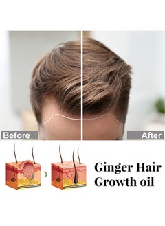 EELHOE Plant Extract Series Hair Growth Oil, Ginger Essential Oil Hair Growth, for Hair Loss, Hair Grow Thicker And Longer, Fast Hair Growth  - Image 5