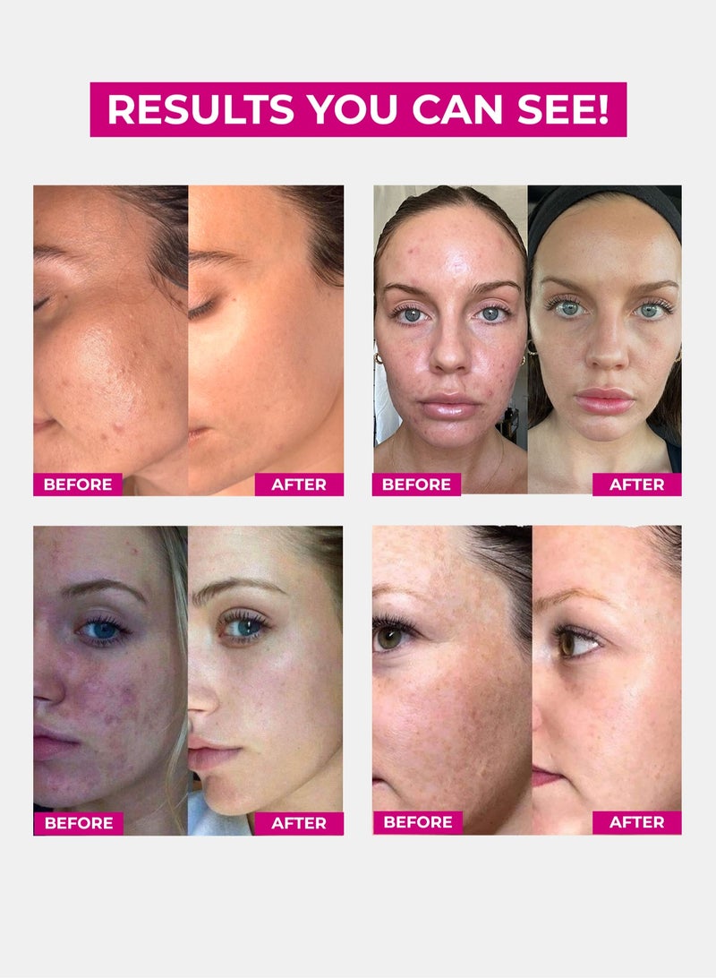 Face Fresh Set of 6 Fairness Face Wash - Acne & Oil Free Skin, Brightens & Clears Skin Pores, Face Wash for All Skin Types 60ml - Image 2