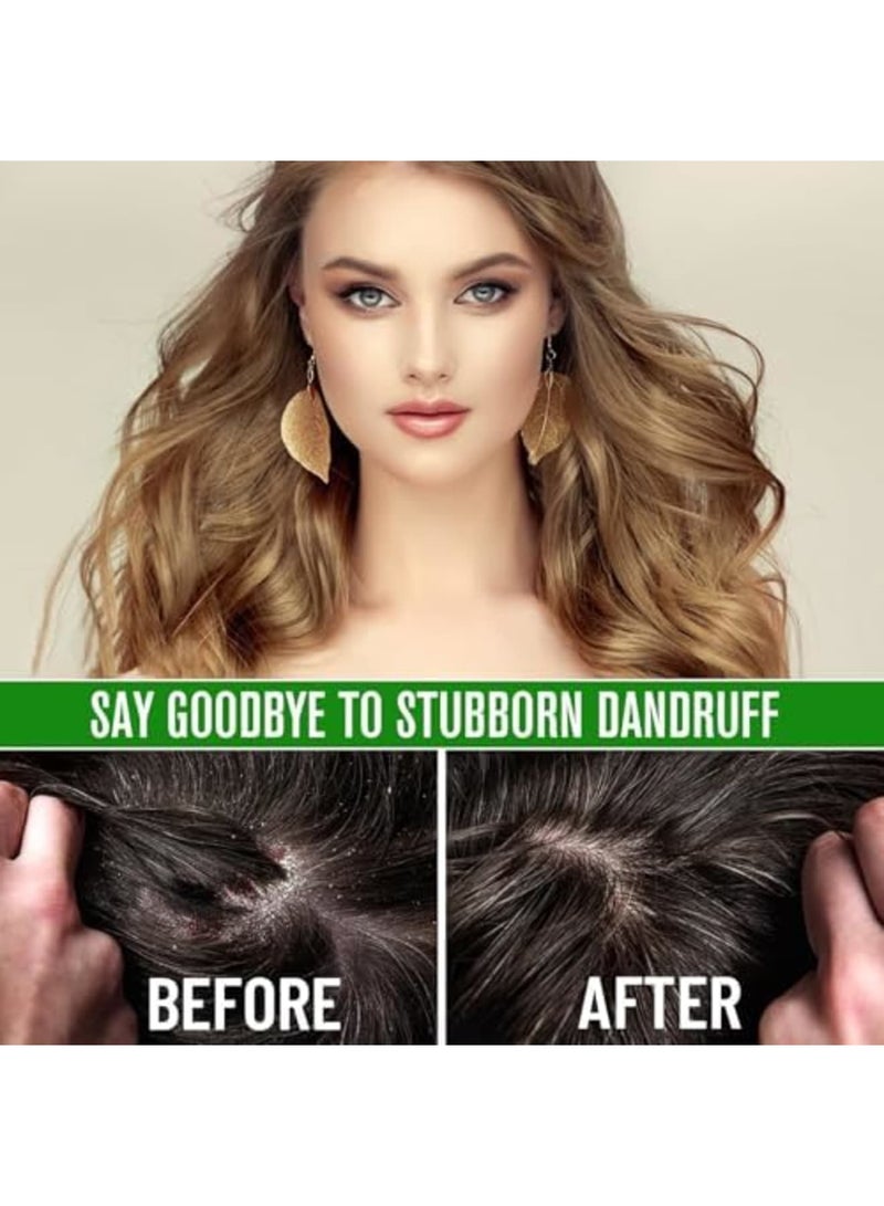 SYOSI Batana Oil with Rosemary for Hair Growth, 100% Organic Batana Oil from Honduras for Hair Growth, Eliminates Split Ends, Enhances Radiance & Nourishment for All Hair Types, 60ml/2.02 fl oz(1PCS) - Image 3