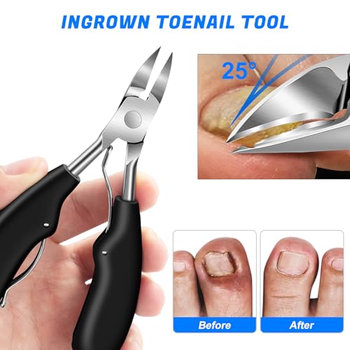 GJNL 2026 Toenail Clippers for Thick Toenails for Seniors Angled Head Large Toe Nail Clippers Set for Men Heavy Duty Ingrown Toenail Clippers with Long Handle Ultra Sharp Slanted Nail Cutter Wide Jaw - Image 3