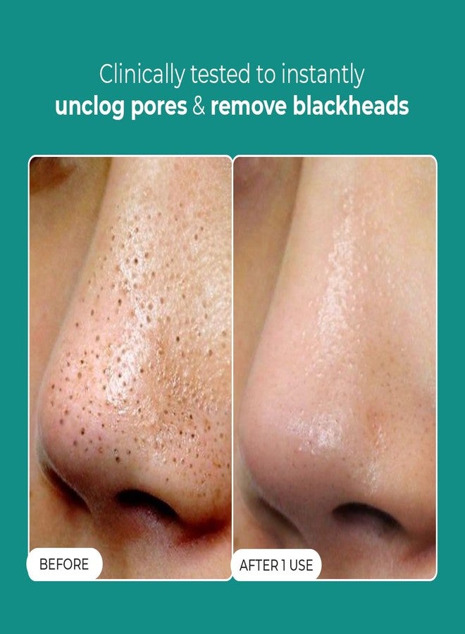 كيميائي واعي ماء إزالة الرؤوس السوداء من كونشيس كيميست® | 50 مل | علاج لطيف للمسام بحمض السكسينيك وحمض الجليكوليك وإكسوسومات السيكا | يفتح المسام، ويزيل الرؤوس السوداء، وينعم البشرة | تونر للرجال والنساء - Image 2