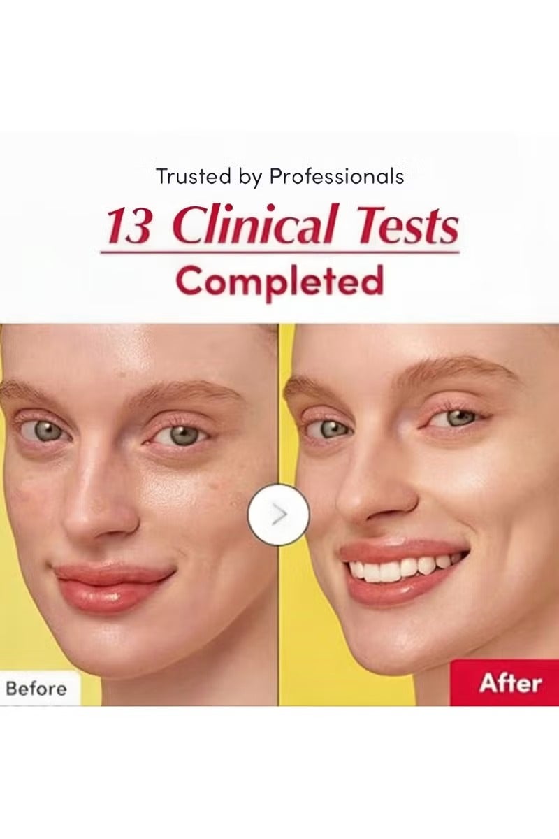 إيكوالبيري مصل فيتامين المضيء – مصن فيتامين سي المضيء مع النياسيناميد | يقوي حاجز البشرة | يرطب باستخدام السيراميد وحمض الهيالورونيك، 1.01 أونصة / 30 مل - Image 4