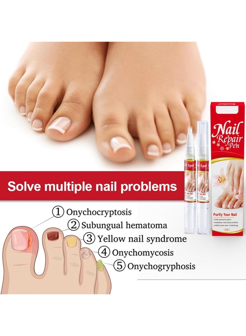 Sumifun قلم سائل لإزالة الفطريات للأظافر واليدين والقدمين 4 مل - Image 2