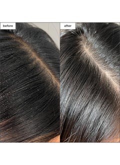 Briogeo Briogeo Scalp Revival Charcoal + Tea Tree Buildup Detox Spray, Dry Scalp Pre-Wash Treatment for Dry Scalp & Itchy Scalp, Build Up, Detox Spray, Unclog Hair Follicles, Vegan, Cruelty-Free, 4 fl oz  - Image 2