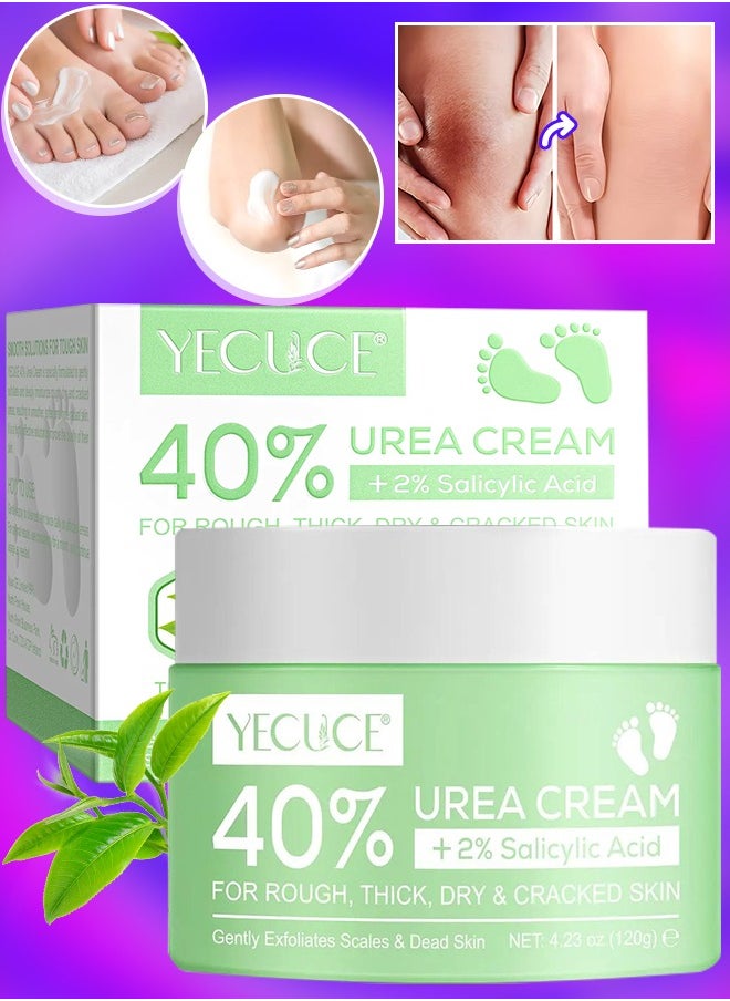 Yecuce 40% Urea Cream for Cracked Feet & Hands with 2% Salicylic Acid 120g Urea Cream for Dry Skin Moisturizer Cream Callus Remover Foot & Hand Cream Care Lotion Nourishes Repairs & Soften Skin  - Image 1