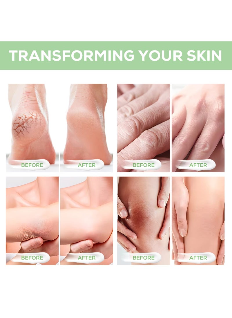Yecuce 40% Urea Cream for Cracked Feet & Hands with 2% Salicylic Acid 120g Urea Cream for Dry Skin Moisturizer Cream Callus Remover Foot & Hand Cream Care Lotion Nourishes Repairs & Soften Skin  - Image 3