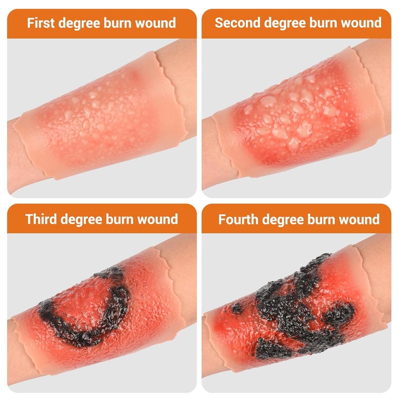 MedEduQuest Burn Wound Packing Trainer Burn Moulages Kit Adhesive Skin Burn Wound Trainer for Wound Care Training Burn Wound Training Model - Image 3