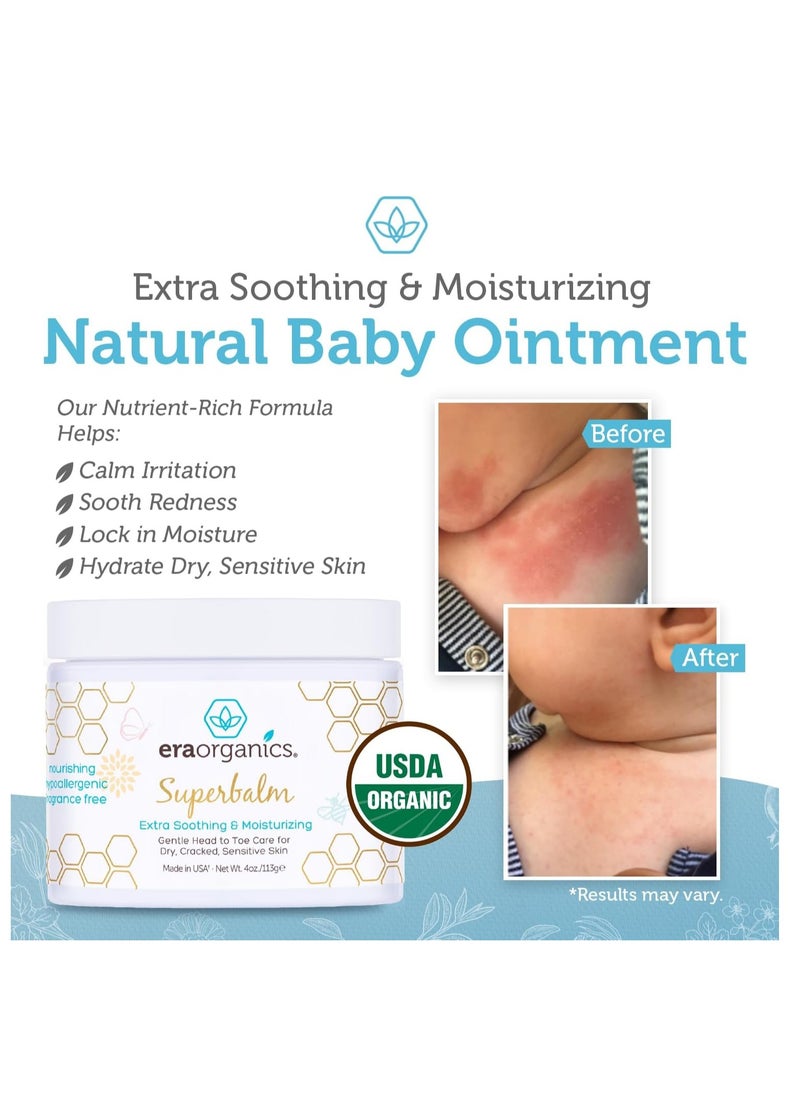 Era Organics Healing Ointment for Babies - USDA Certified Organic Natural Gentle Moisturizer for Sensitive Skin Prone To Baby Eczema, Cradle Cap (Infant Seborrheic Dermatitis), Rashes & Hives (4 oz.) - pzsku/ZCB7B4EDCB9D467F69861Z/45/_/1715782964/dbb20c01-f14e-4f84-9c0e-c353caadd46f