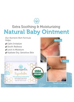 Era Organics Era Organics Healing Ointment for Babies - USDA Certified Organic Natural Gentle Moisturizer for Sensitive Skin Prone To Baby Eczema, Cradle Cap (Infant Seborrheic Dermatitis), Rashes & Hives (4 oz.)  - Image 5