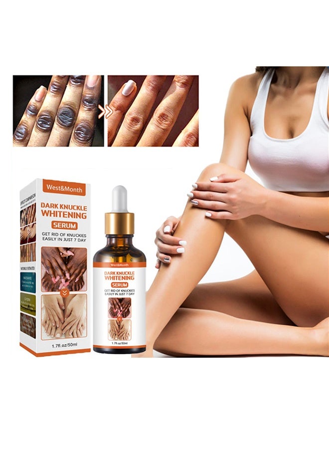 West&Month Dark Knuckle Whitening Serum - Restoring Hand Treatment, Moisturizing, Exfoliates and Reduces Unbalanced Pigmentation, for Removing Dark Knuckle Elbow, Brighter, Firmer Skin - Image 2