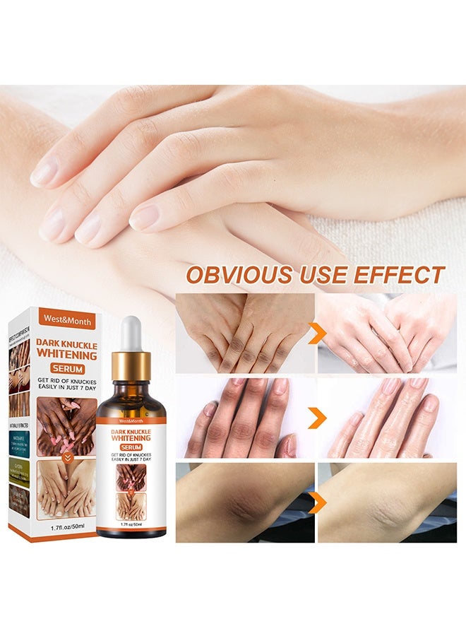 West&Month Dark Knuckle Whitening Serum - Restoring Hand Treatment, Moisturizing, Exfoliates and Reduces Unbalanced Pigmentation, for Removing Dark Knuckle Elbow, Brighter, Firmer Skin - Image 5