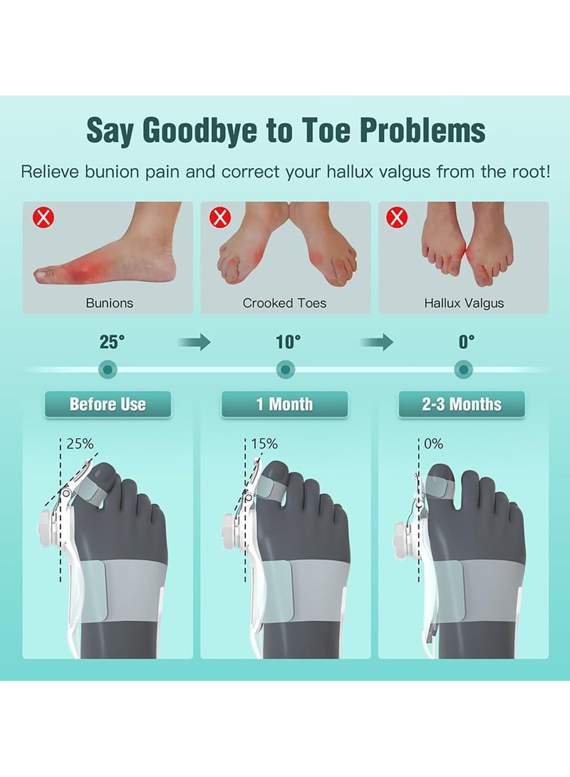 جود تول 1 قطعة مصحح الإبهام, مصحح إبهام القدم, جبيرة بونيون بمقبض قابل للتعديل, لتخفيف الوكعة, أدوات تخفيف الألم, مناسب لتصحيح أصابع القدم اليمنى واليسرى - Image 2