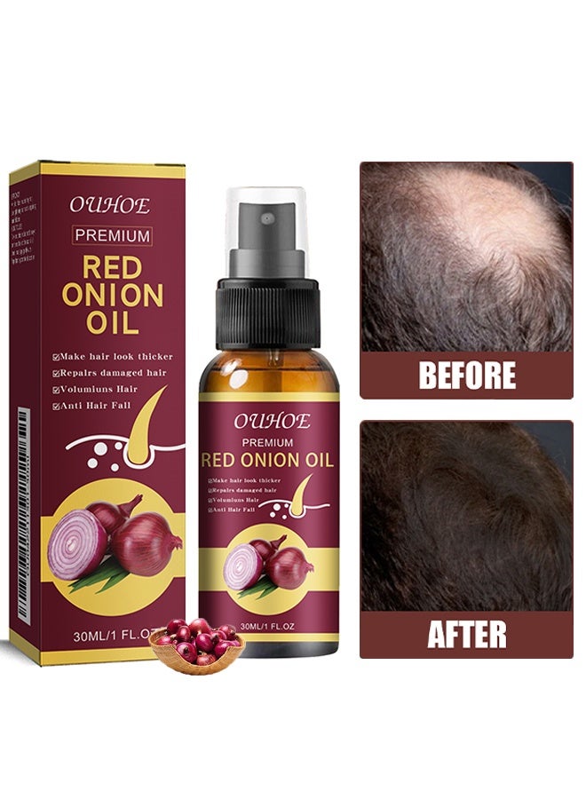 OUHOE Red onion Oil，Make hair look thicker，Repalrs damaged hair，Volumiuns Hair&，Anti Hair Fall，Thinning Treatment Hair Growth Oil for Women & Men 30ML - Image 1