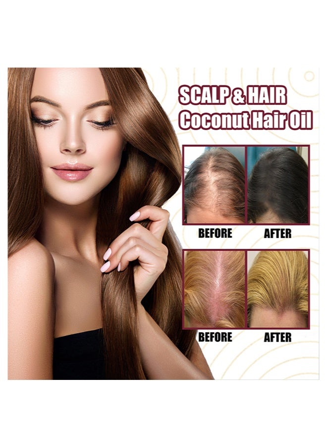 OUHOE Red onion Oil，Make hair look thicker，Repalrs damaged hair，Volumiuns Hair&，Anti Hair Fall，Thinning Treatment Hair Growth Oil for Women & Men 30ML - Image 4