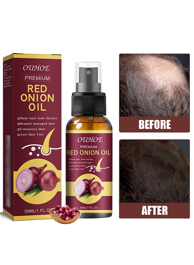 أوهو زيت البصل الأحمر ، جعل الشعر يبدو أكثر كثافة ، الشعر التالف ، Volumiuns للشعر ، مضاد لتساقط الشعر ، زيت نمو الشعر الخفيف للنساء والرجال 30 مل - Image 1