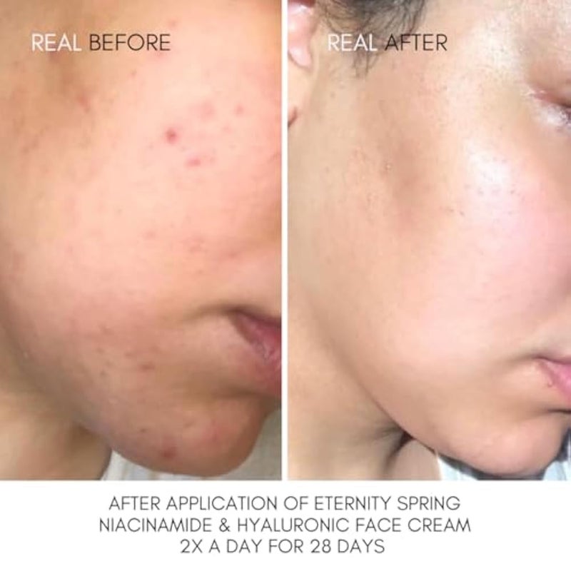 Nut Botanicals Eternity Spring Niacinamide And Hyaluronic Face Cream 120 Ml - Image 2