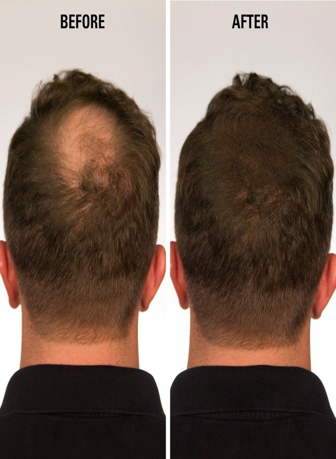 إيكليبس إنستانت هير فيلر ألياف إكليبس للشعر بلون بني محمر للشعر الخفيف للنساء والرجال لإخفاء تساقط الشعر في 15 ثانية - ألياف بناء شعر غير مرئية 100%، 15 غرام - Image 5