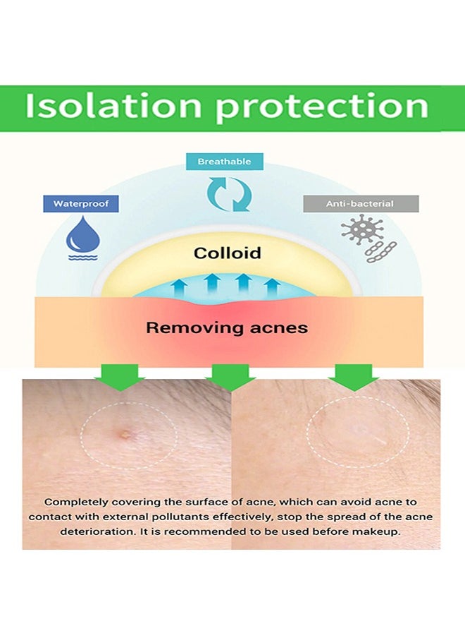 Breylee 22 Patches Acne Pimple Patch -Oil Control Anti Acne Facial Care ，Acne Spot ，Cystic Acne，Fungal Acne ，Face Acne Spot Treatment and Acne Scar Treatment Post Acne Marks Treatment，Pimple Remover Daily Use  - Image 4
