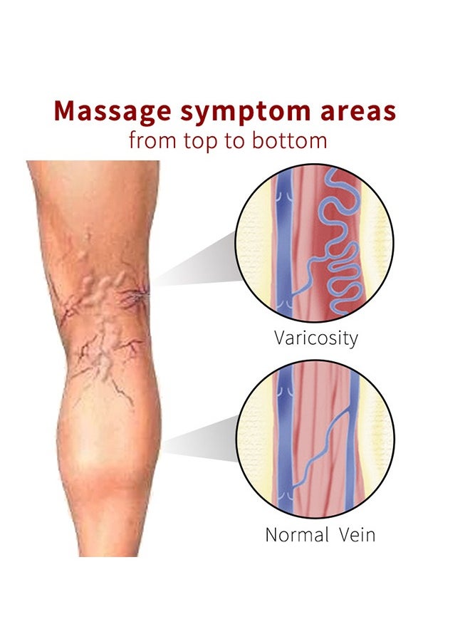 KanyeHB - Varicose Veins Treatment Patch For Legs, Promote Metabolism And Improve Blood Circulation, Relief Heavy Tired Leg 12PCS - Image 1