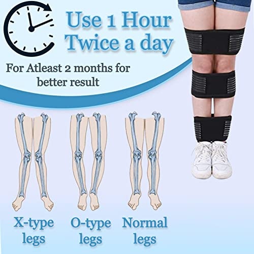 NUCARTURE Adjustable Bow Leg Correction Belt for Men Women Knock Knee Corrector O/X Type Legs Belt for bowed Leg Straightener Brace Knee Genu Valgum o/x Support belt Day & Night (X-Large,Black) - Image 2