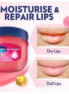 Unilever Vaseline Lip Therapy Rosy Lips  - Image 2