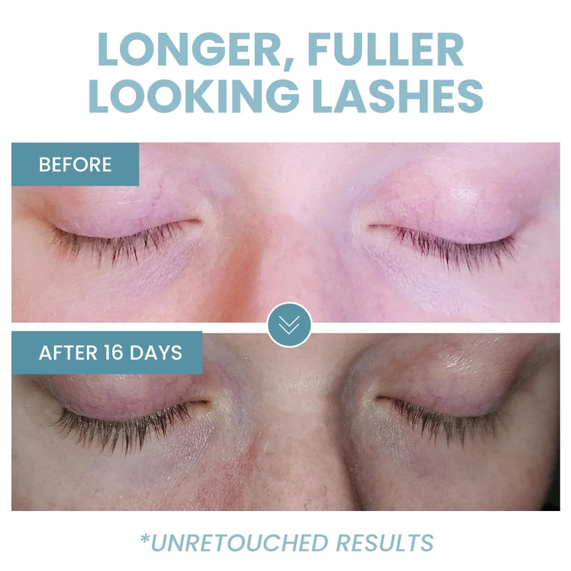 Eva Naturals 100% Pure Castor Oil â€“ Cold Pressed for Eyelash, Eyebrow, Hair & Lash Growth, Thicker Brow & Face Serum Drops for Wrinkles, Hydrating & Nourishing Oil for Skin, Lashes & Brows, 2oz - Image 5