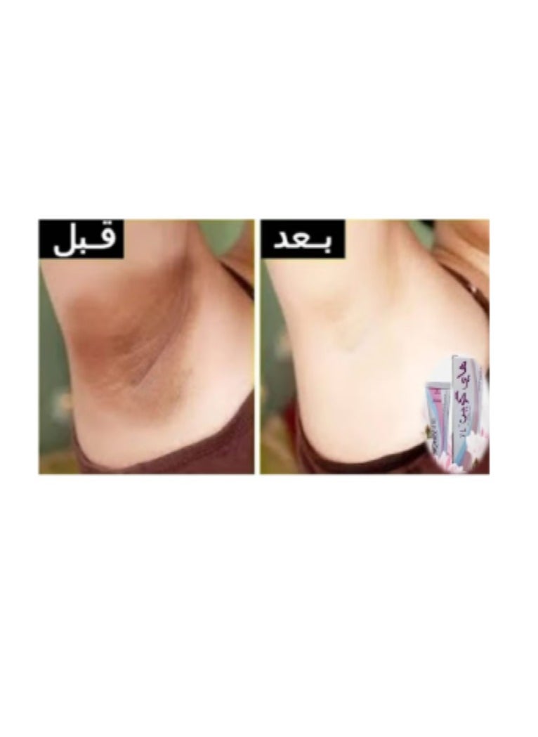 Jamjoom Medical solution Acretin 0.025% Tretinoin Cream 30g + Hi Quin Pro Whitening Acne Treatment 4% Cream 30 gm  - Image 4