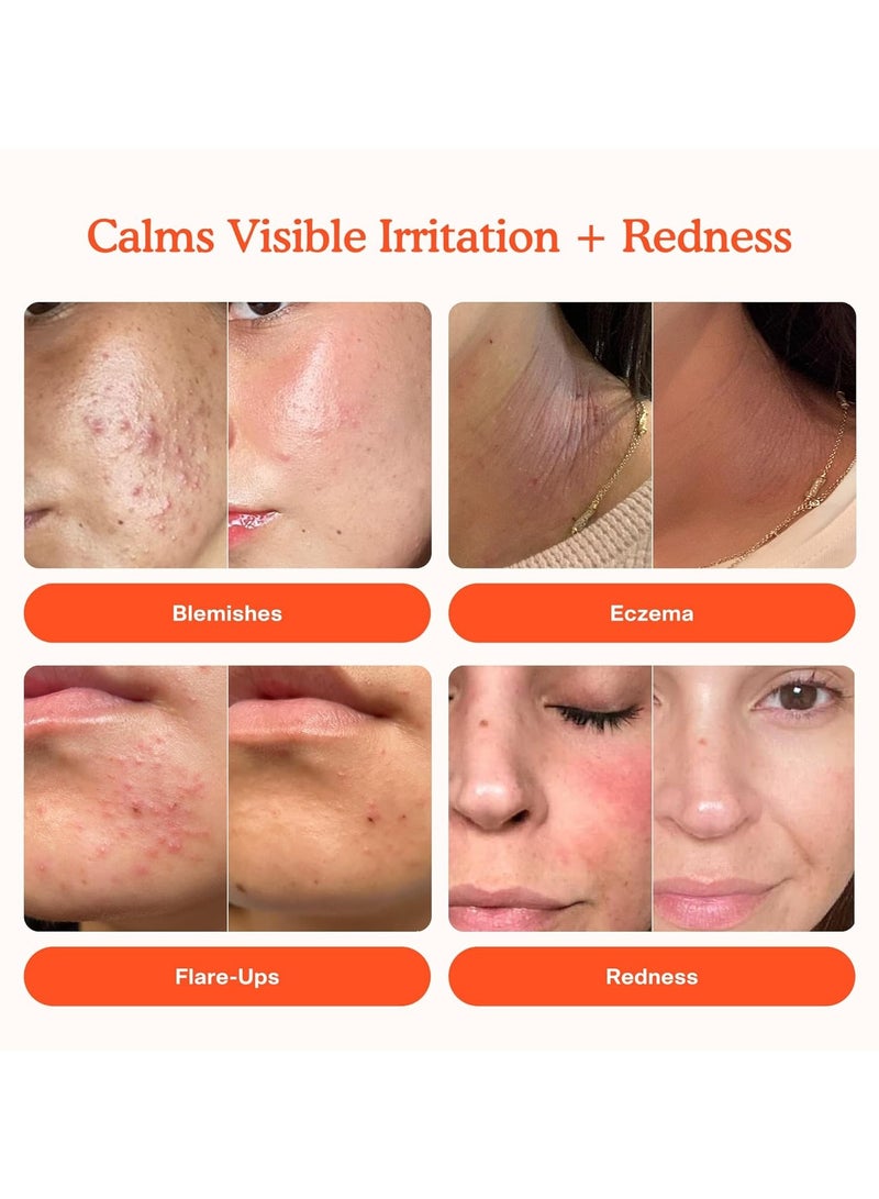 TOWER 28 SOS Daily Rescue Facial Spray for Sensitive Skin, Hypochlorous Acid Spray Helps Reduce Redness and Breakouts, Full Size Toner for Face, 4 FL Oz - Image 2