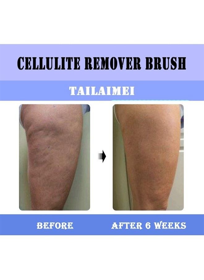 TailaiMei - Anti Cellulite Massager Brush, Body Shower Scrubber for Cellulite Remover - Improve Circulation Fascia Muscle Release Brush(Blue) - Image 1