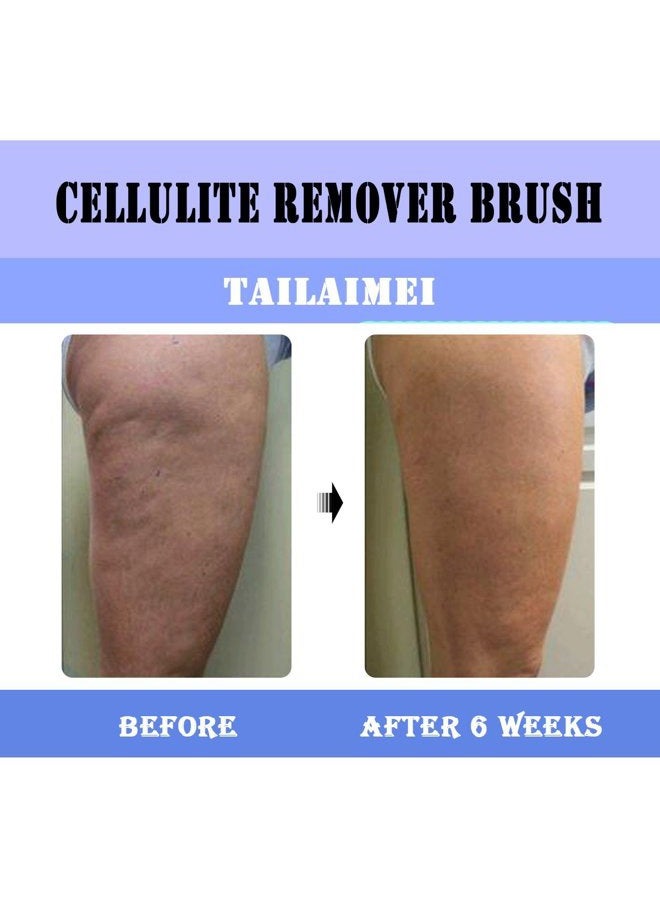 TailaiMei Cellulite Remover Fascia Release Massager Brush with Flexible Nubs for Skin Health and Anti Cellulite Treatment (Blue) - Image 3