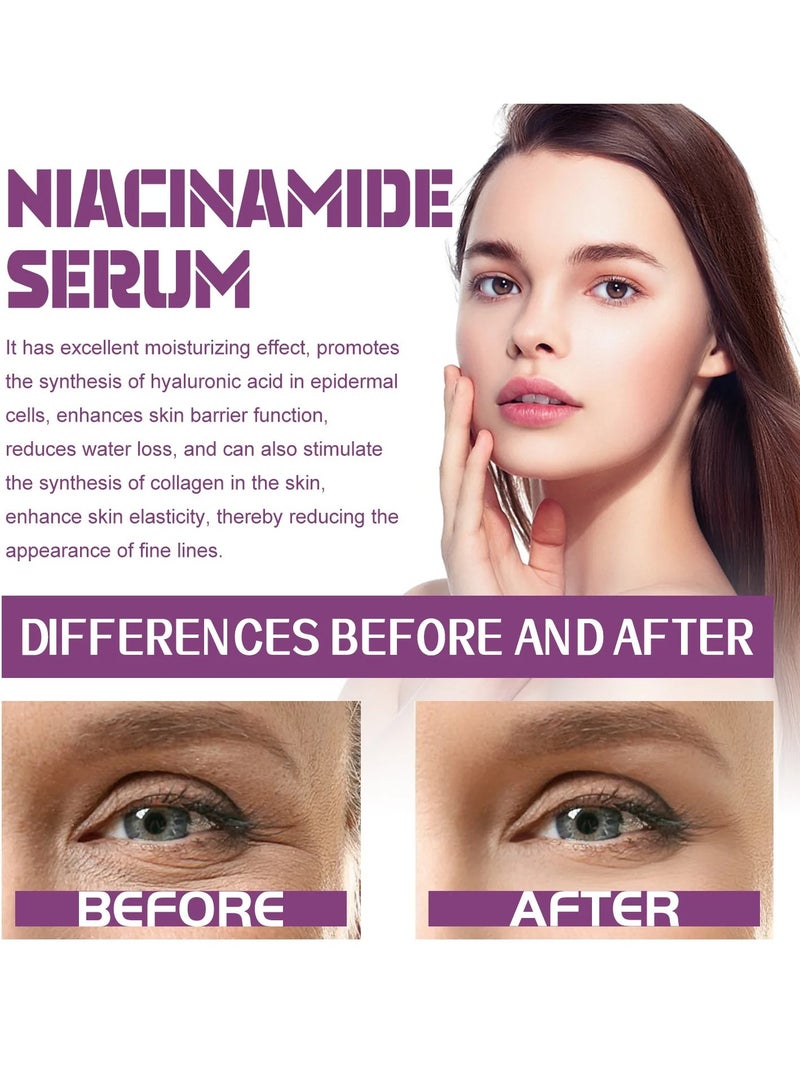 EELHOE Niacinamide Vitamin B3 Concentrated Serum, 20ml Face Pigment Dark Spot Remover Face Serum, Anti Aging Fragrance Free Face Essence For For Discoloration And Minimizing Large Pores - Image 3
