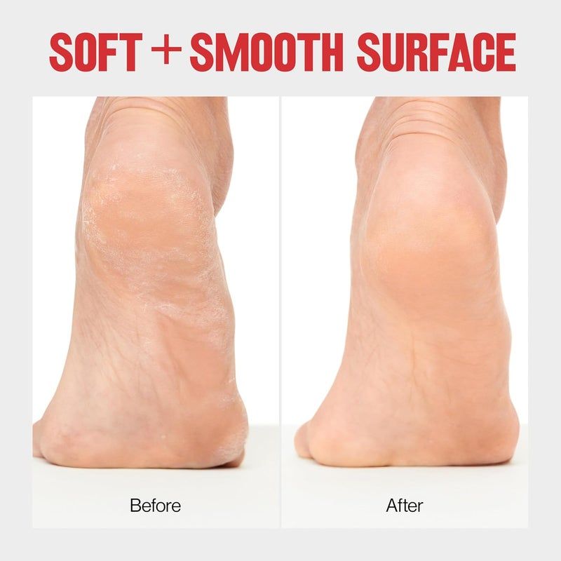 Revlon WetDry Foot File - Image 4