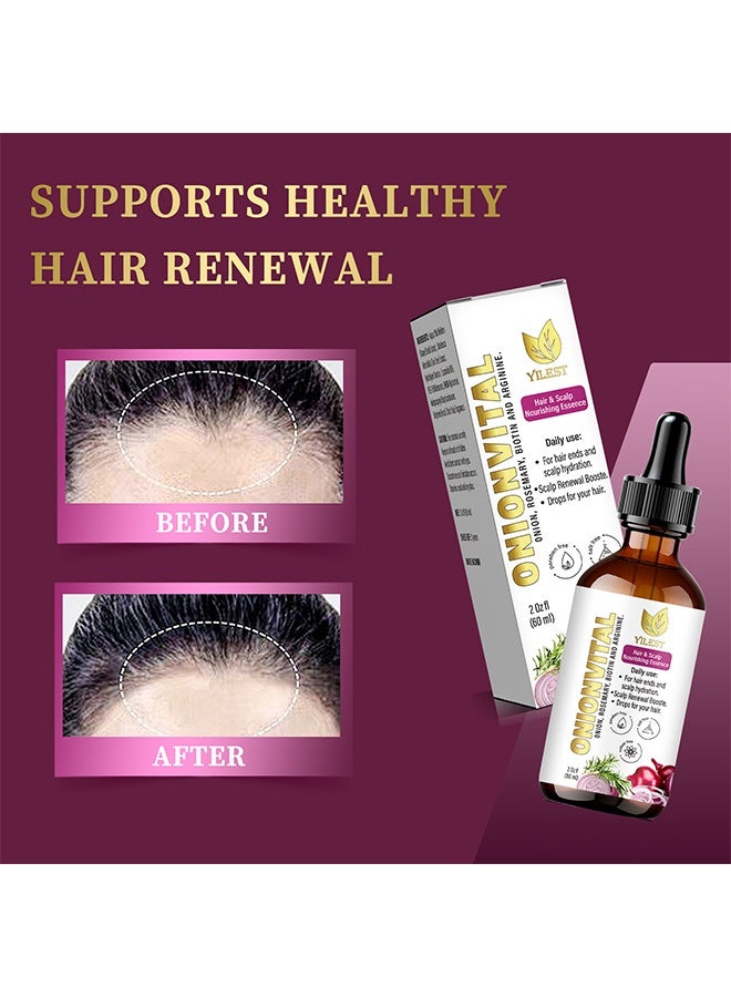 YILEST Onion biotin and rosemary hair care essence - Enhances Frizz and Makes Hair Soft and Smooth. Onion Hair Care Essence Liquid 60ml - Image 5