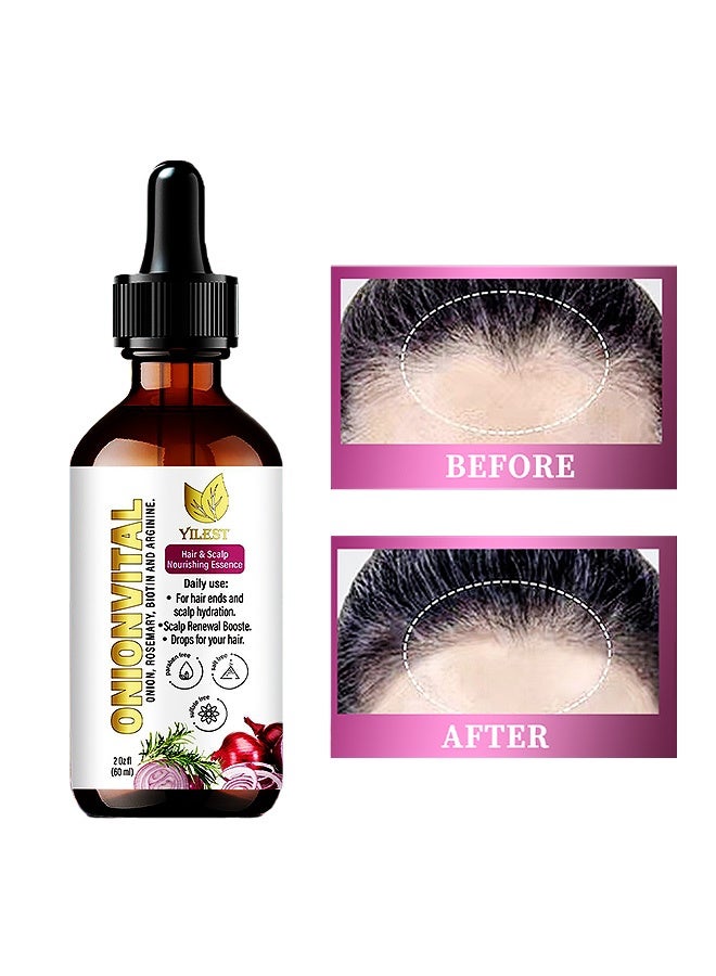 YILEST Onion biotin and rosemary hair care essence - Enhances Frizz and Makes Hair Soft and Smooth. Onion Hair Care Essence Liquid 60ml - Image 1