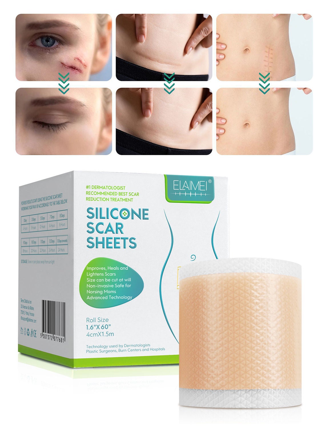 Elaimei Silicone Scar Sheets Effective Safe Breathable Comfortable Long ...
