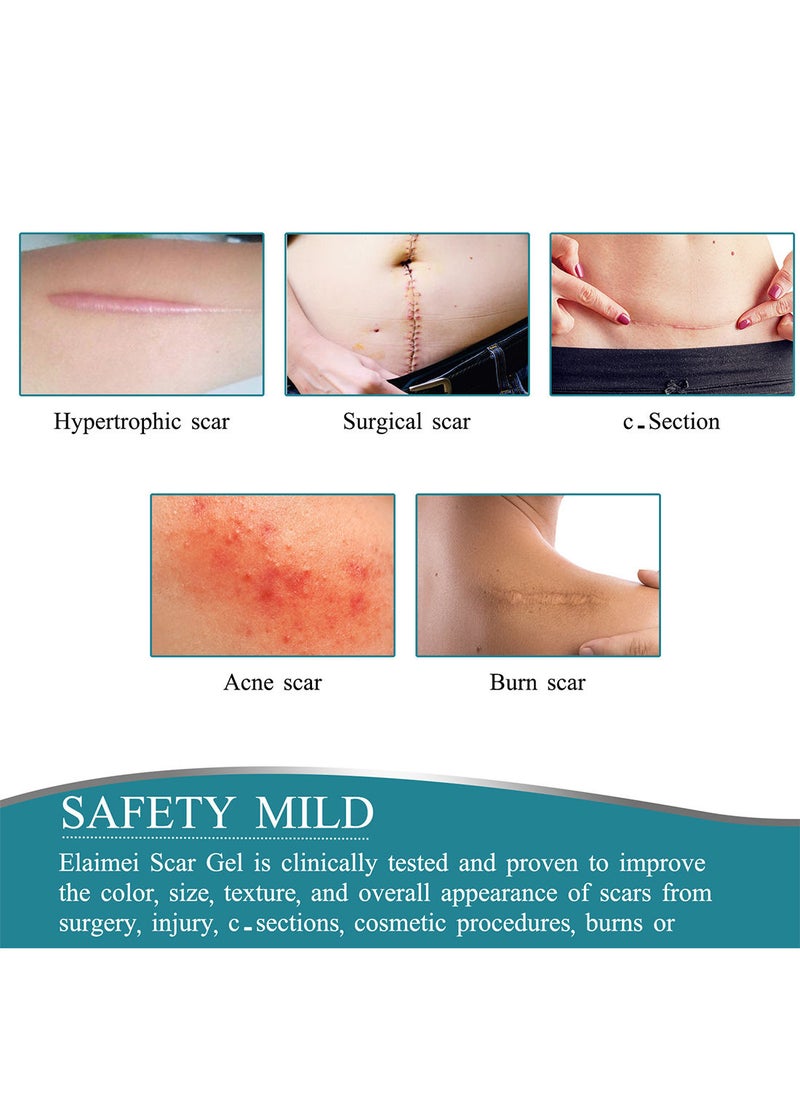 Elaimei - Silicone Scar Sheets Effective Safe Breathable Comfortable Long-Lasting Results Scar Care Adopt Advanced Technology to Improve Heal and Lighten Scars for Old and New Scars 4cm*1.5m - Image 1