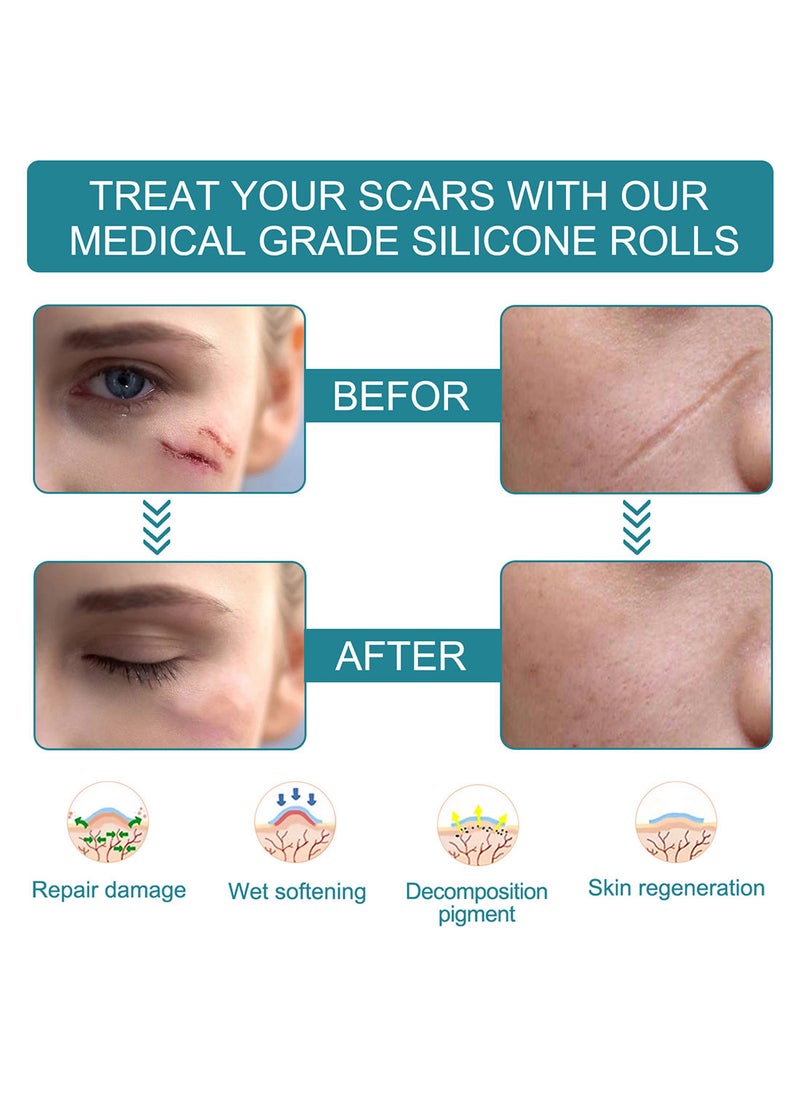 Elaimei - Silicone Scar Sheets Effective Safe Breathable Comfortable Long-Lasting Results Scar Care Adopt Advanced Technology to Improve Heal and Lighten Scars for Old and New Scars 4cm*1.5m - Image 1