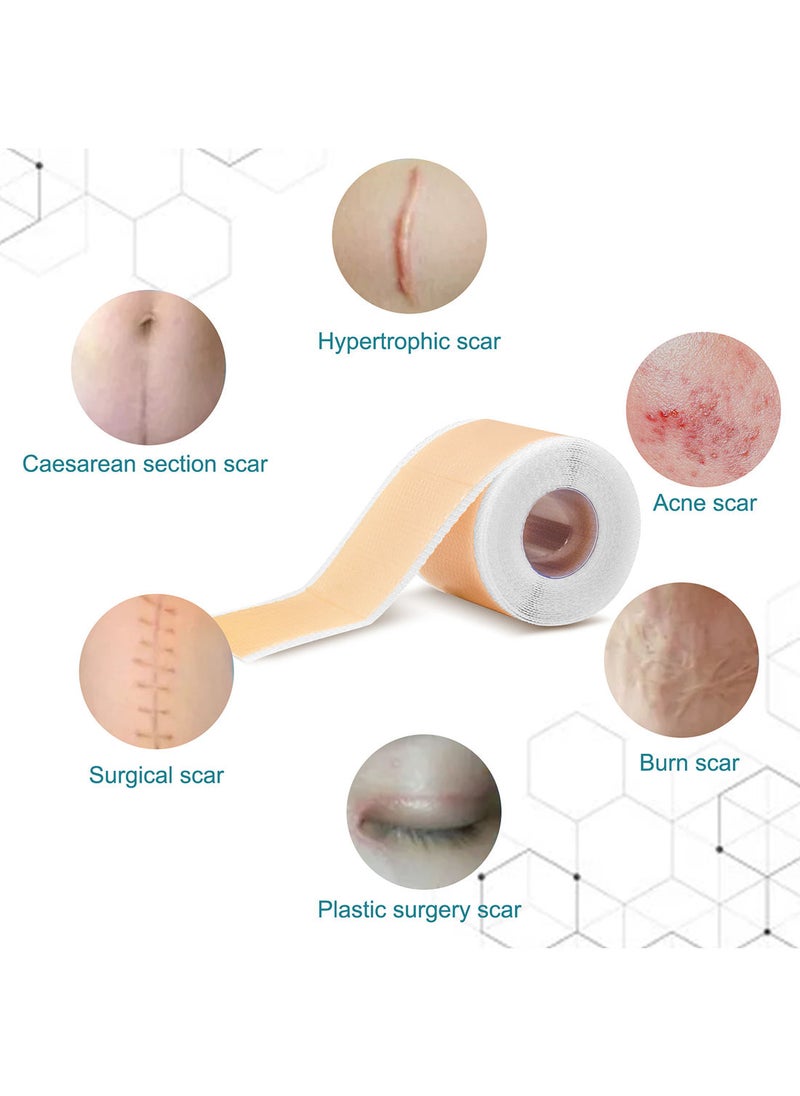 Elaimei - Silicone Scar Sheets Effective Safe Breathable Comfortable Long-Lasting Results Scar Care Adopt Advanced Technology to Improve Heal and Lighten Scars for Old and New Scars 4cm*1.5m - Image 1