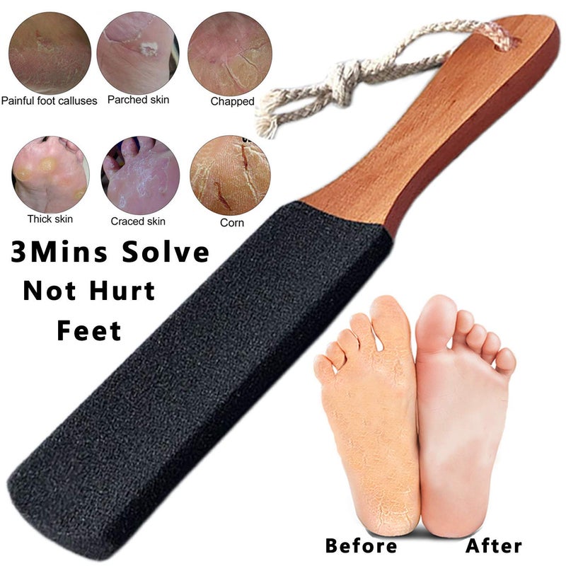 Kinepi Foot Scrubber Pedicure Foot File Pumice Stone,Professional Pedicure Supplies Callus Remove Cracked Heels,Dead Skin,Corn,Scraper File Foot Care Foot Rasp Massage Brush Tools Kit for Men/Women - Image 2