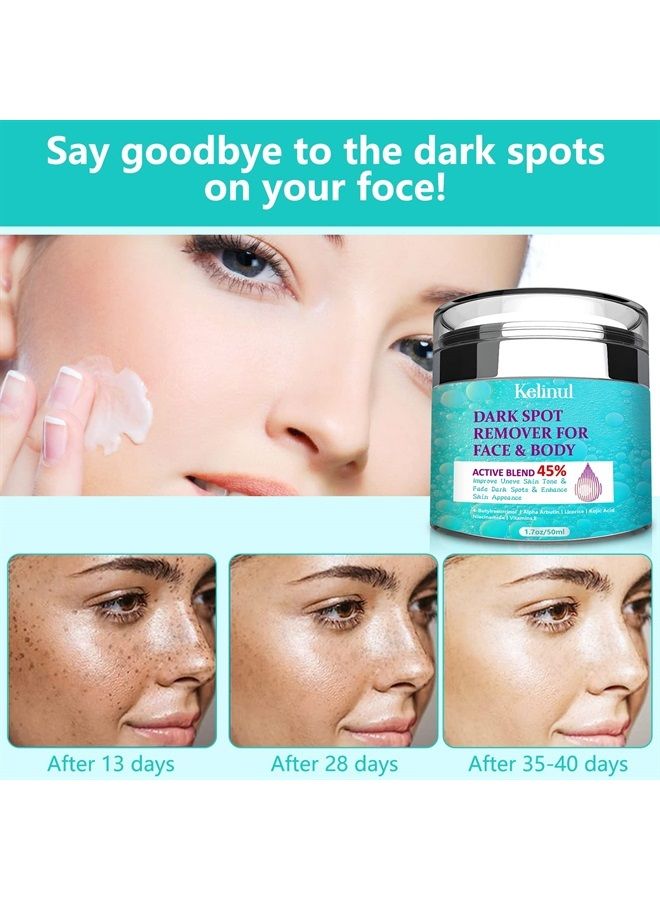 Kelinul Dark Spot Corrector Remover for Face and Body, Formulated with Advanced Ingredient 4-Butylresorcinol, Kojic Acid, Lactic Acid and Salicylic Acid (60) - Image 3