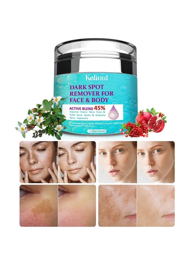 Kelinul Dark Spot Corrector Remover for Face and Body, Formulated with Advanced Ingredient 4-Butylresorcinol, Kojic Acid, Lactic Acid and Salicylic Acid (60) - Image 1