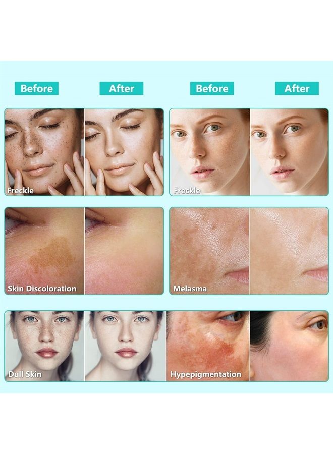 Kelinul Dark Spot Corrector Remover for Face and Body, Formulated with Advanced Ingredient 4-Butylresorcinol, Kojic Acid, Lactic Acid and Salicylic Acid (60) - Image 2