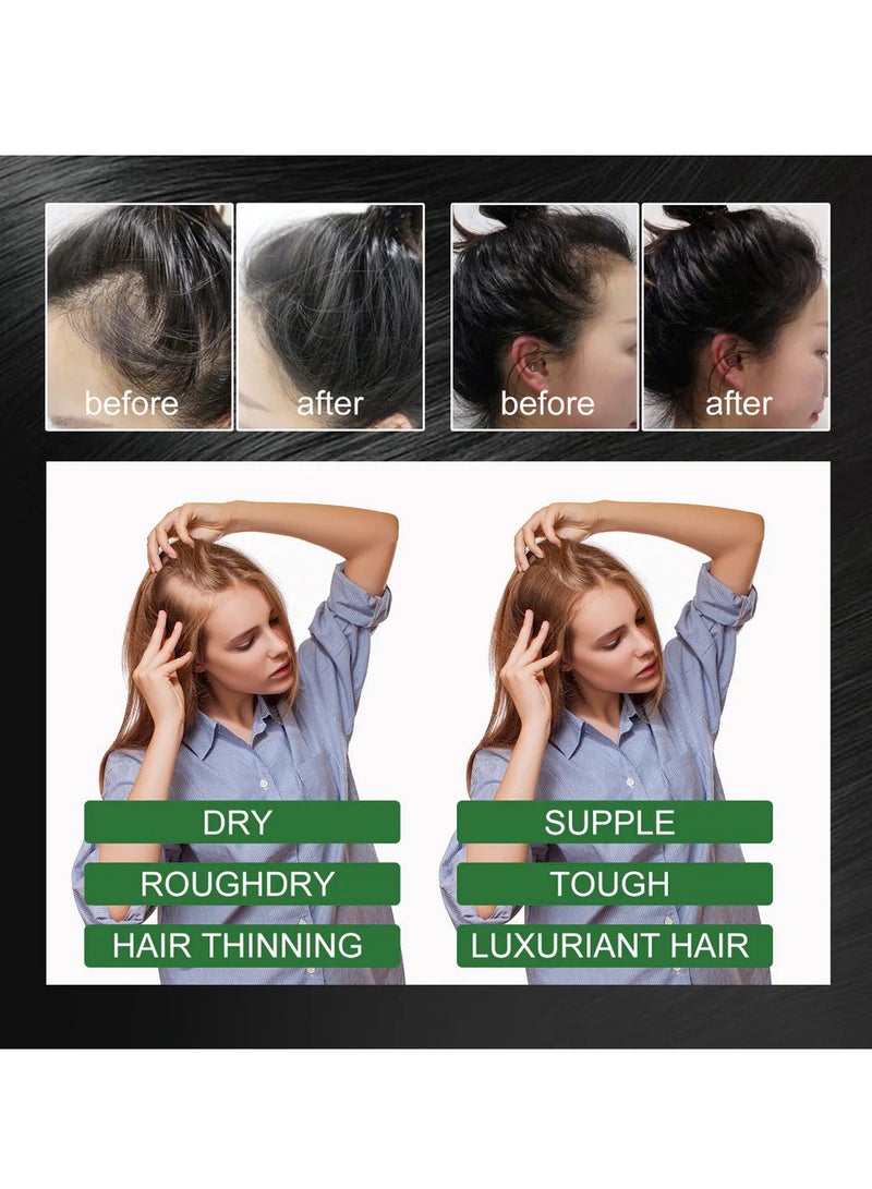 OUHOE 60 ml Rosemary Essential Oil for Hair Growth Pure Organic Rosemary Oil for Dry Damaged Hair and Growth Hair Scalp Oil Pure and Natural Premium Quality Oil Hair Loss Treatment Oil - Image 4