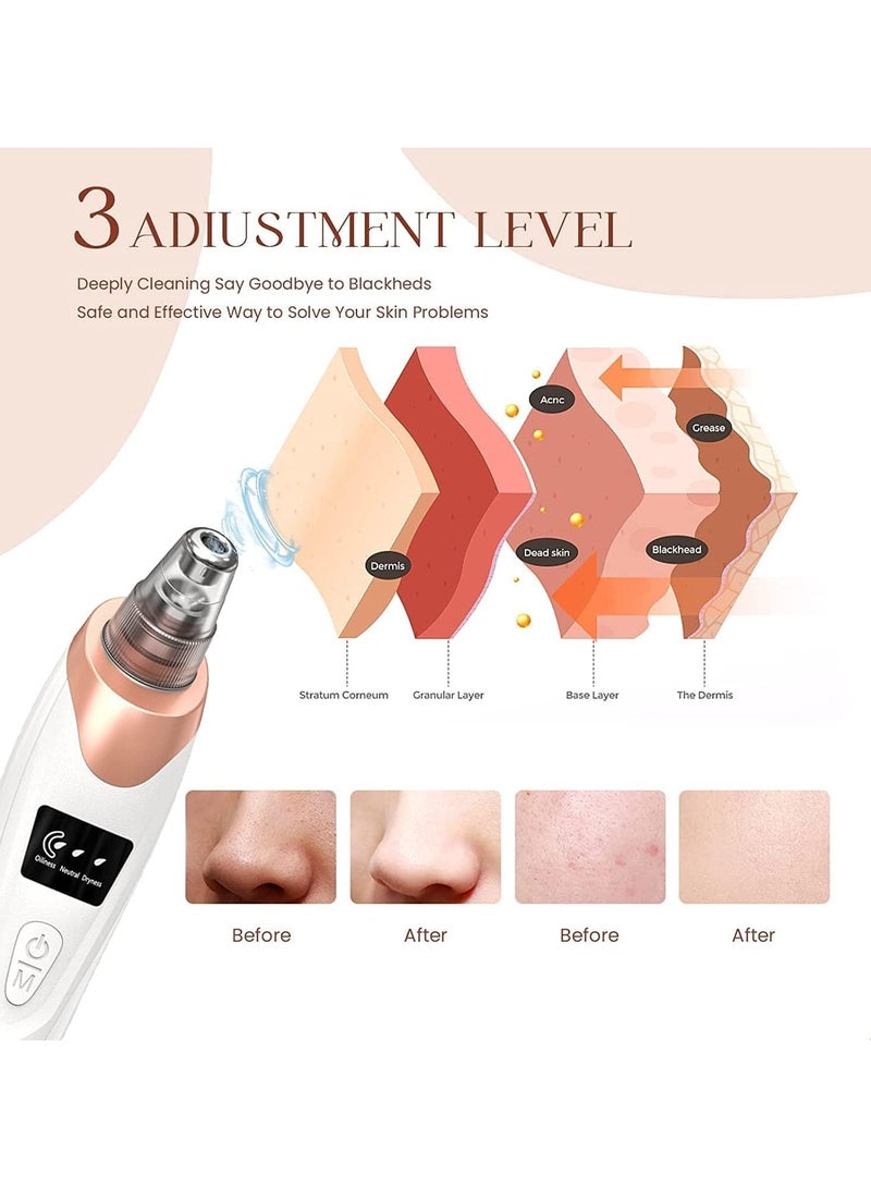 Blackhead Remover Pore Vacuum,Facial Pore Cleaner-5 Suction Power,5 Probes,USB Rechargeable Blackhead Vacuum Kit Electric Acne Extractor Tool for Adult  - Image 4