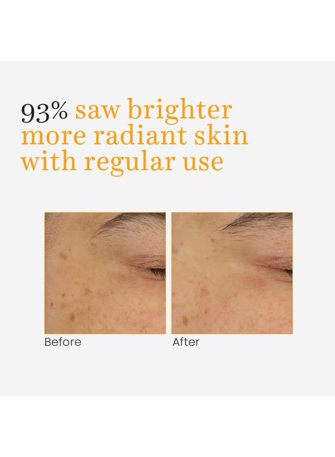 O3+ Vitamin C & Turmeric Glow Gel Cream for Women & Men Turmeric + Rosemary (50gm) - Image 4