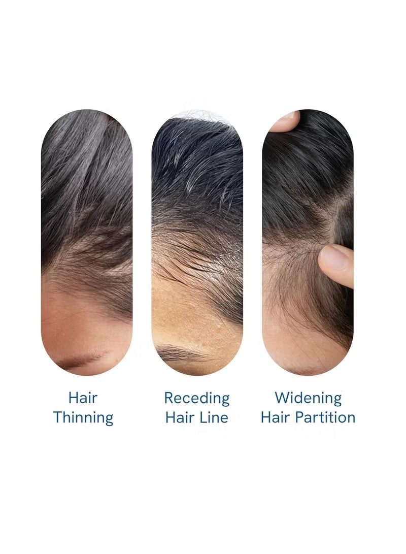 Be Bodywise 3% Redensyl & Rosemary Hair Growth Serum (Roll On) | Pack of 1 | 2% Anagain | Thicker & Stronger Hair | Prevents Hairfall & Stimulates Hair Follicles | For All Hair Types | 25 ml - Image 3